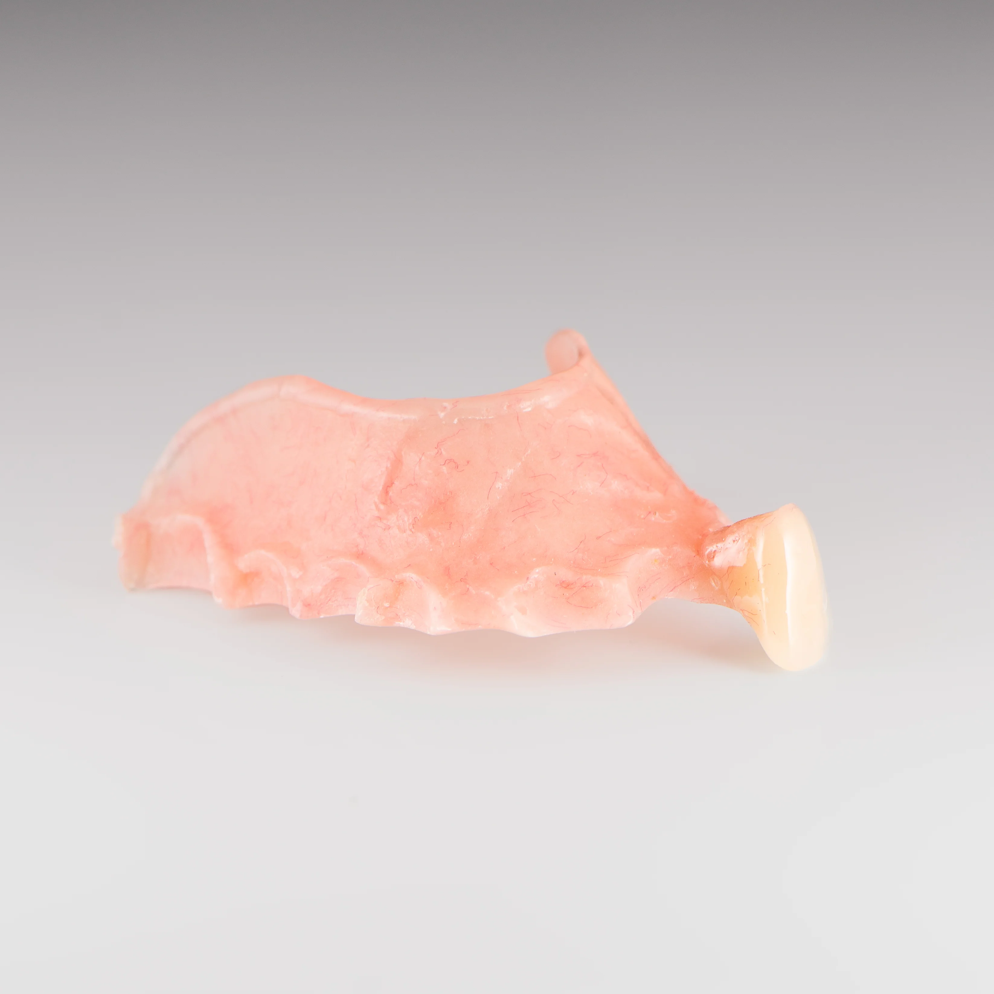 Acrylic Partial Flipper Denture - Image 7