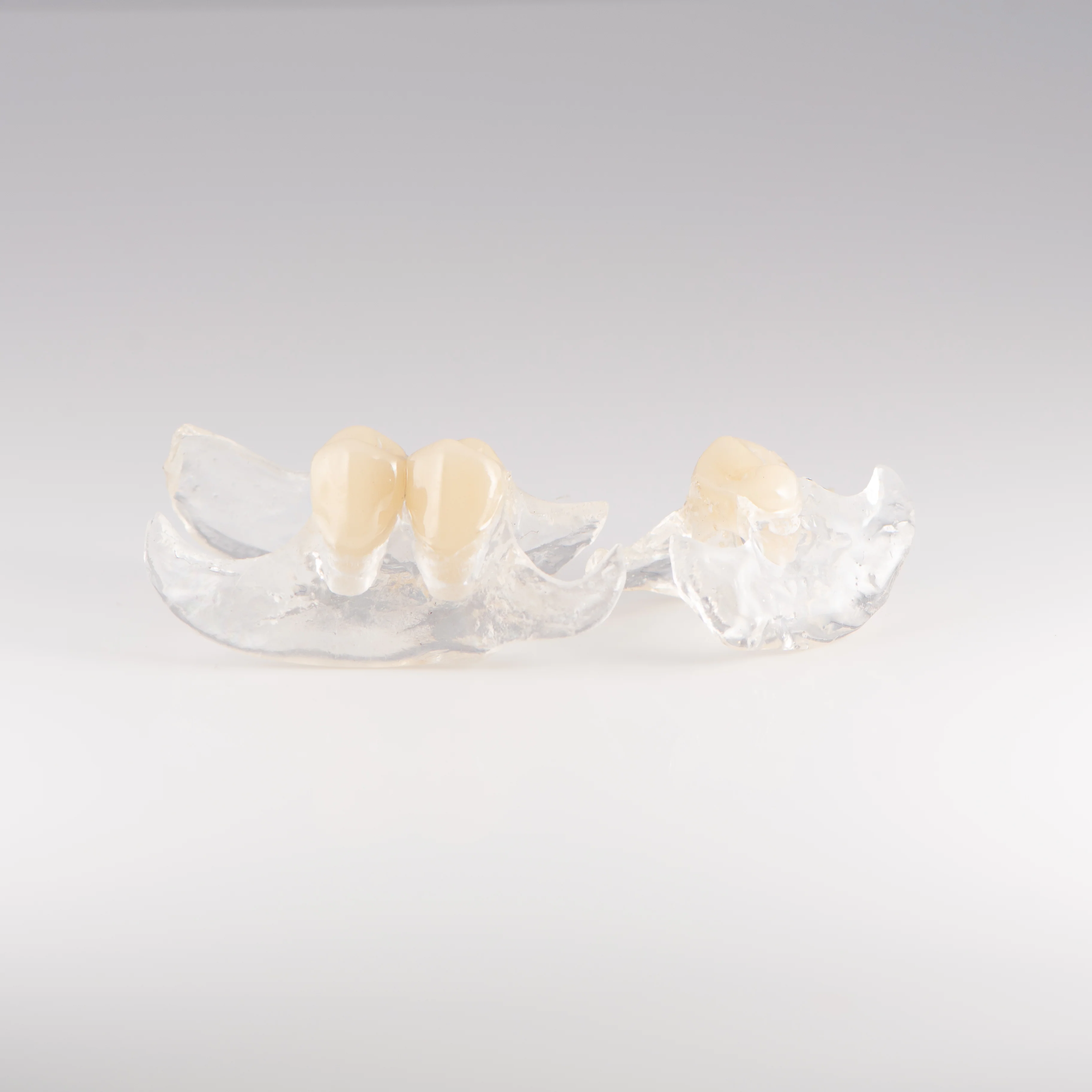 Clear Unilateral Partial Denture - Image 3