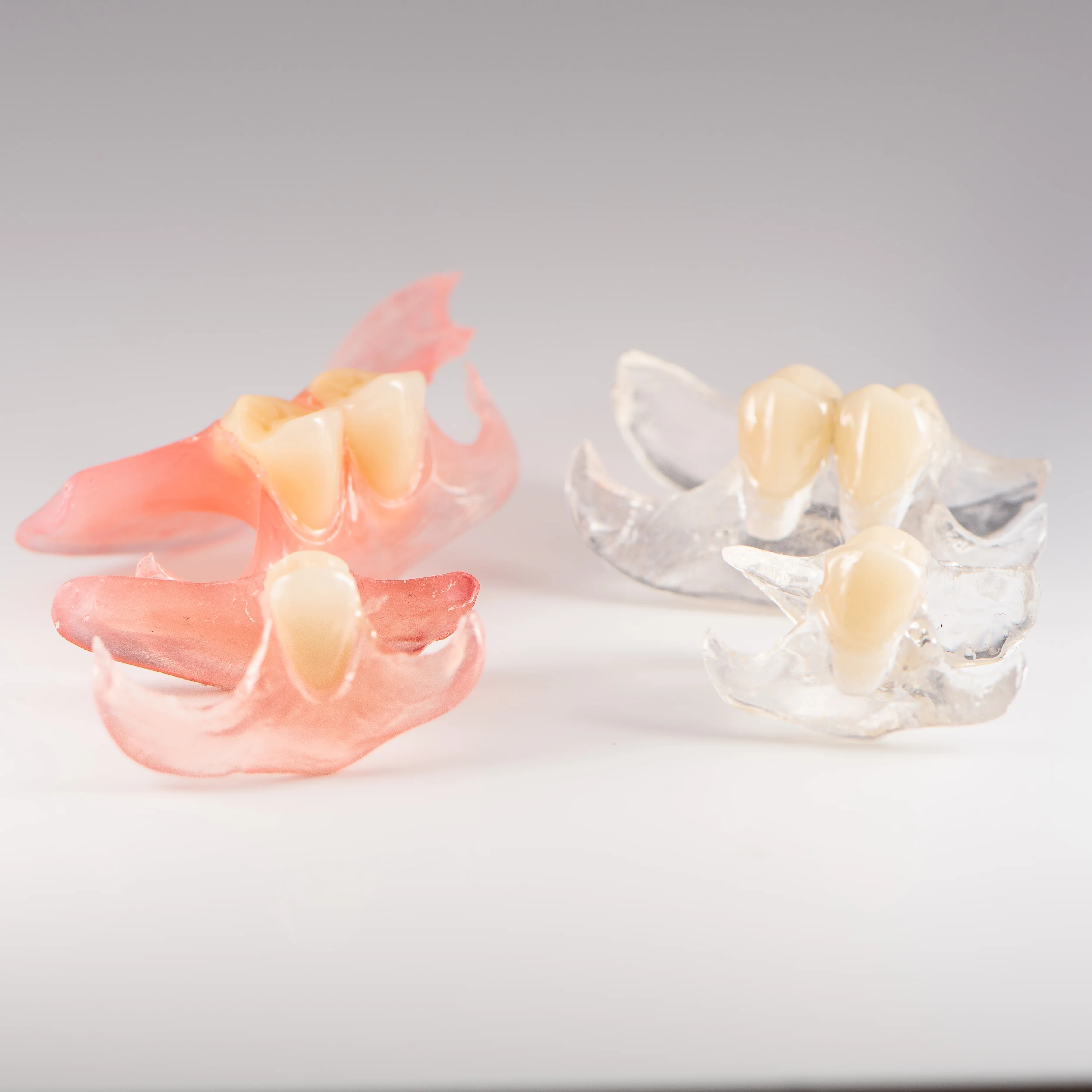 Clear Unilateral Partial Denture - Image 4