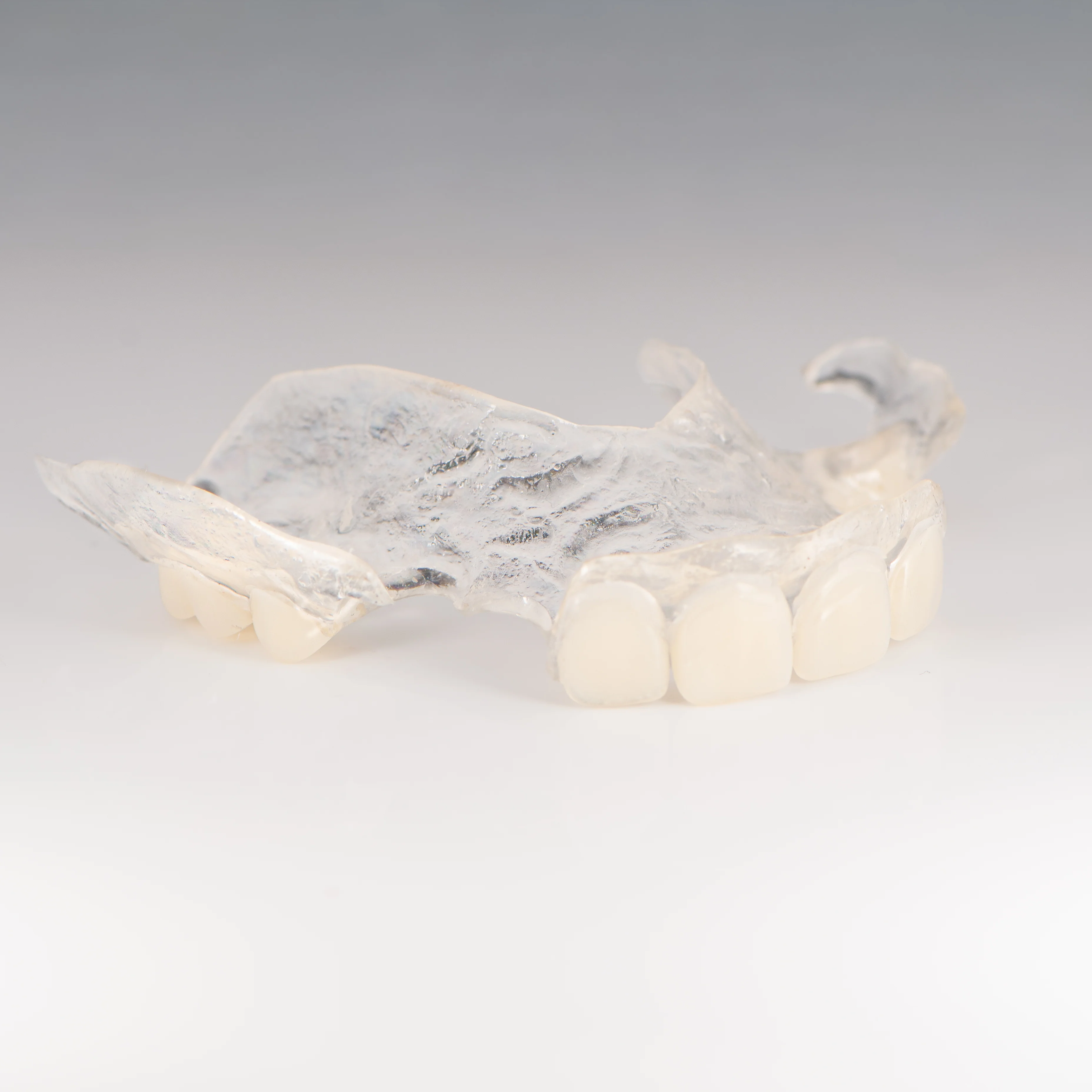 Clear Flexible Partial Denture - Image 4
