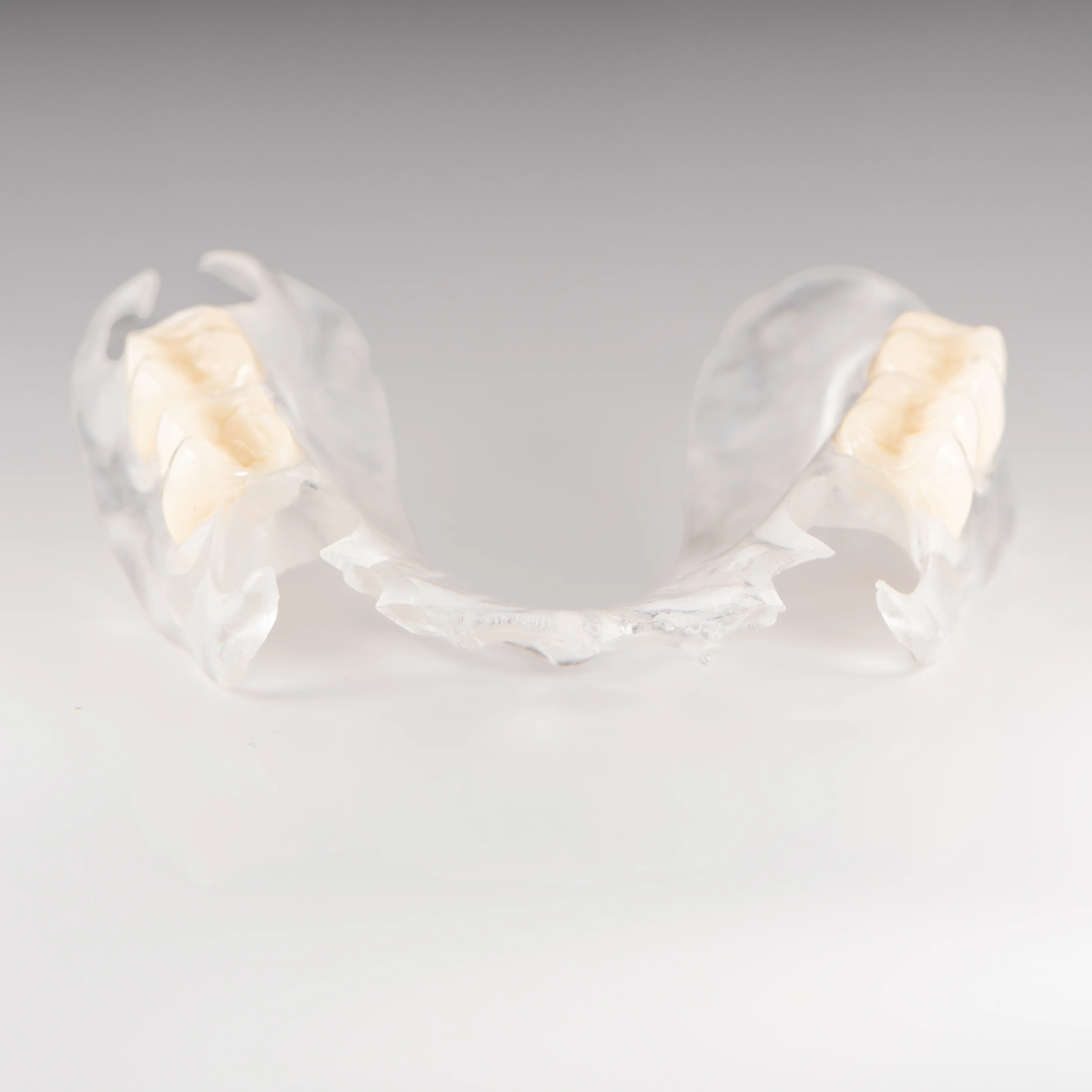 Clear Flexible Partial Denture - Image 5