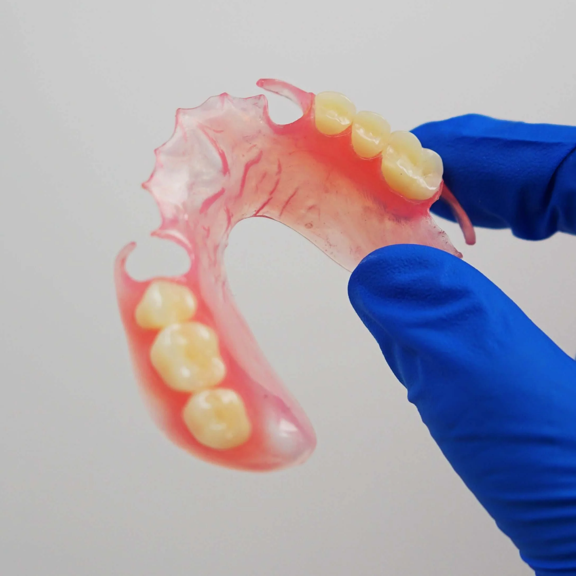 Flexible Partial Denture - Image 11