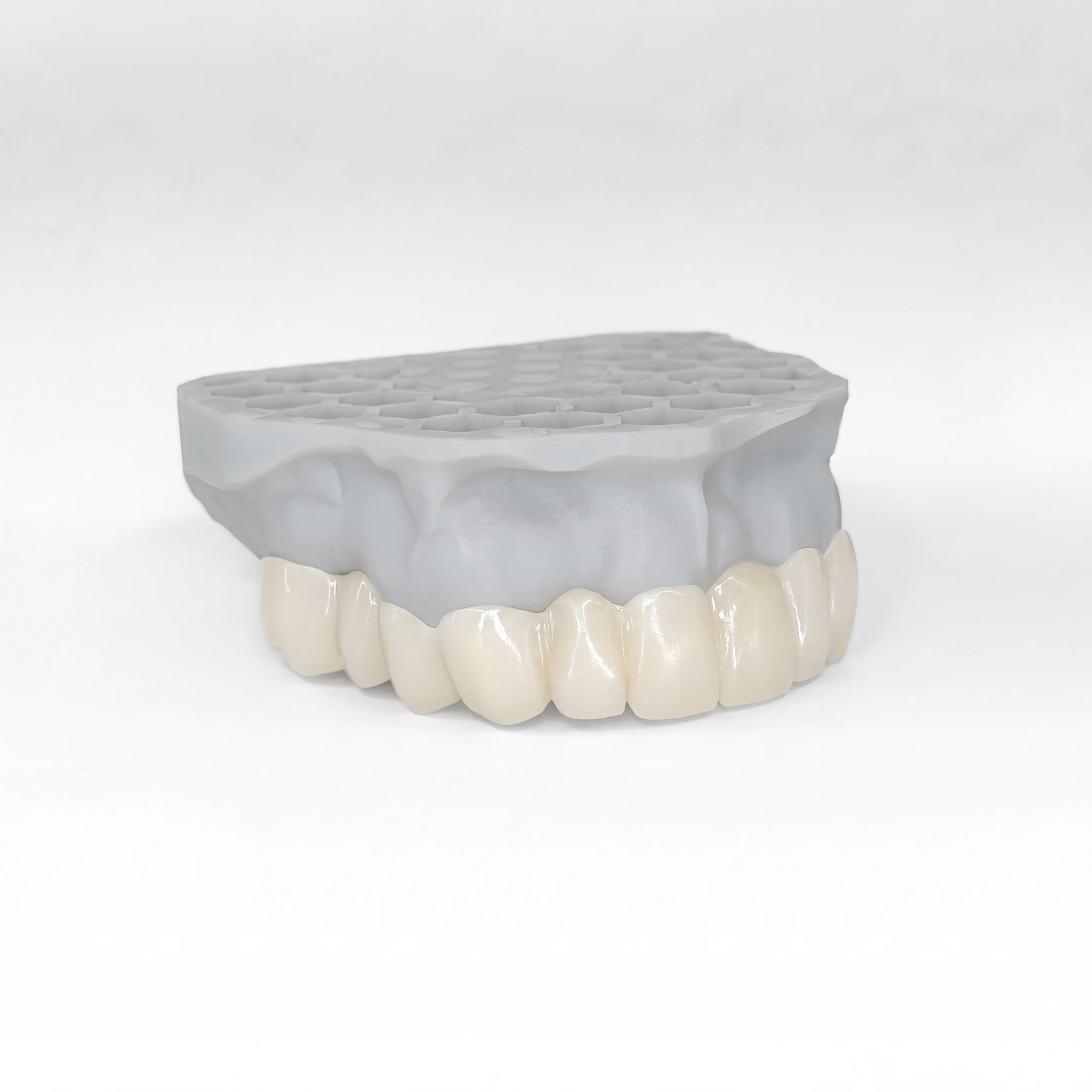 Revived Veneers - Image 4