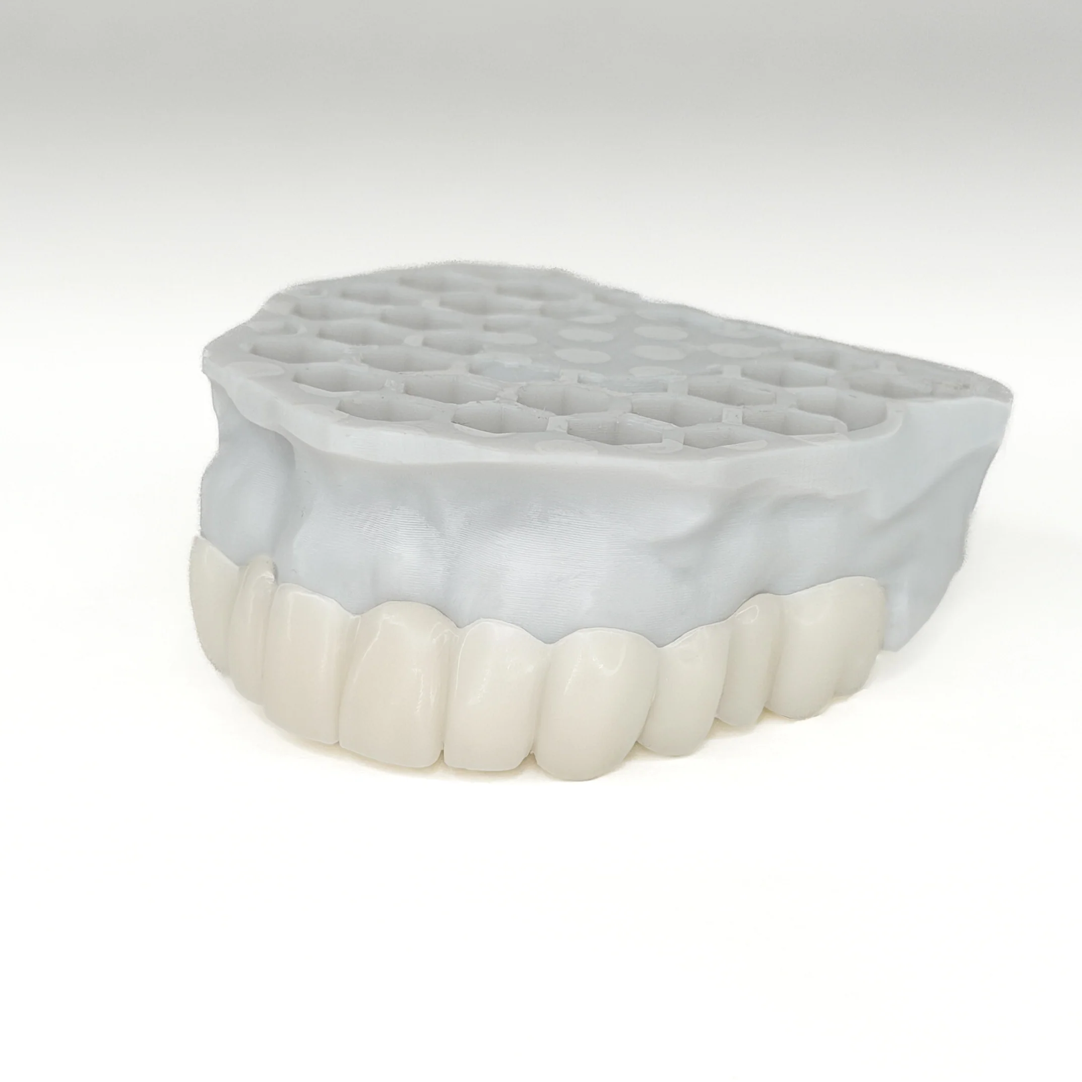 Revived Veneers - Image 5