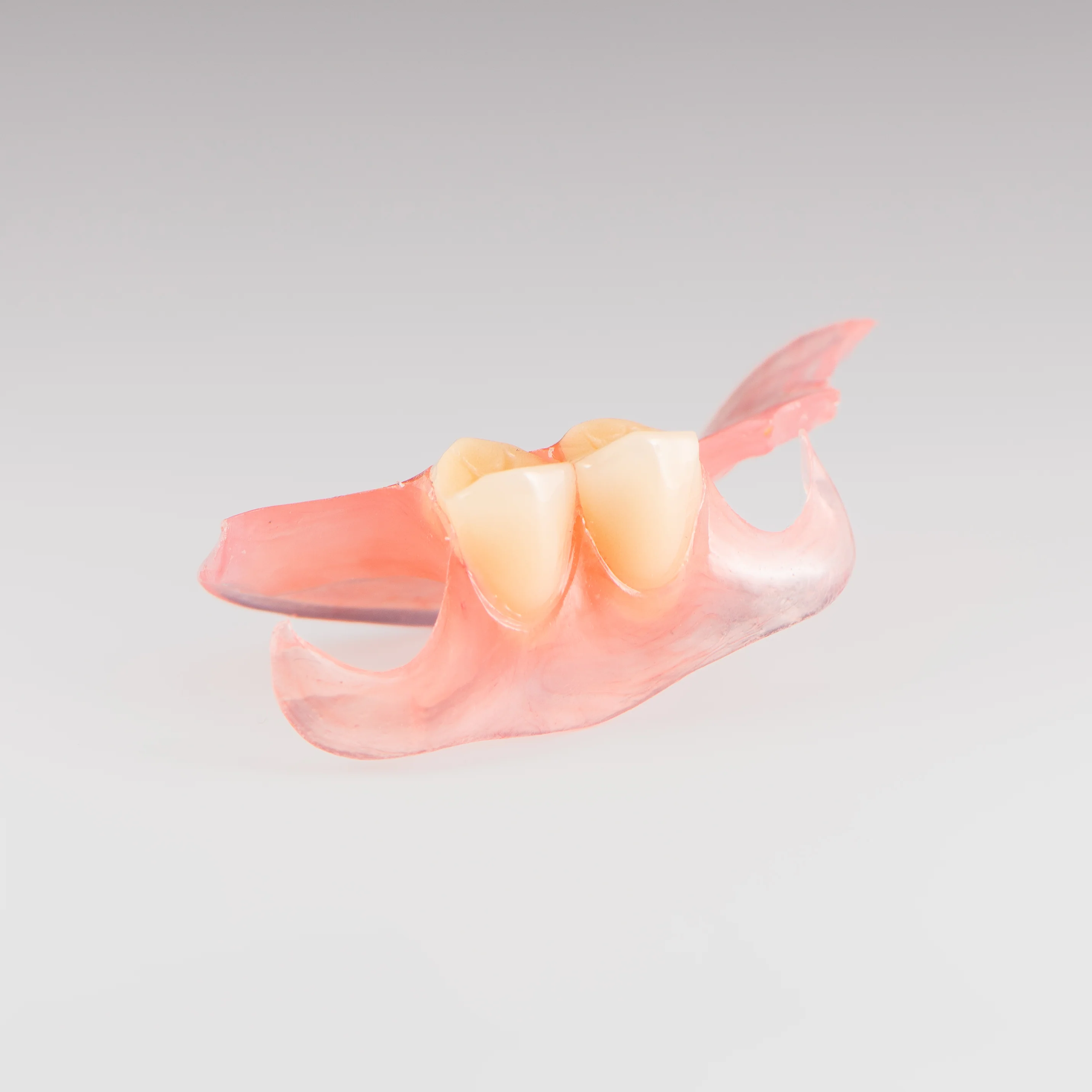 Unilateral Partial Denture - Image 6