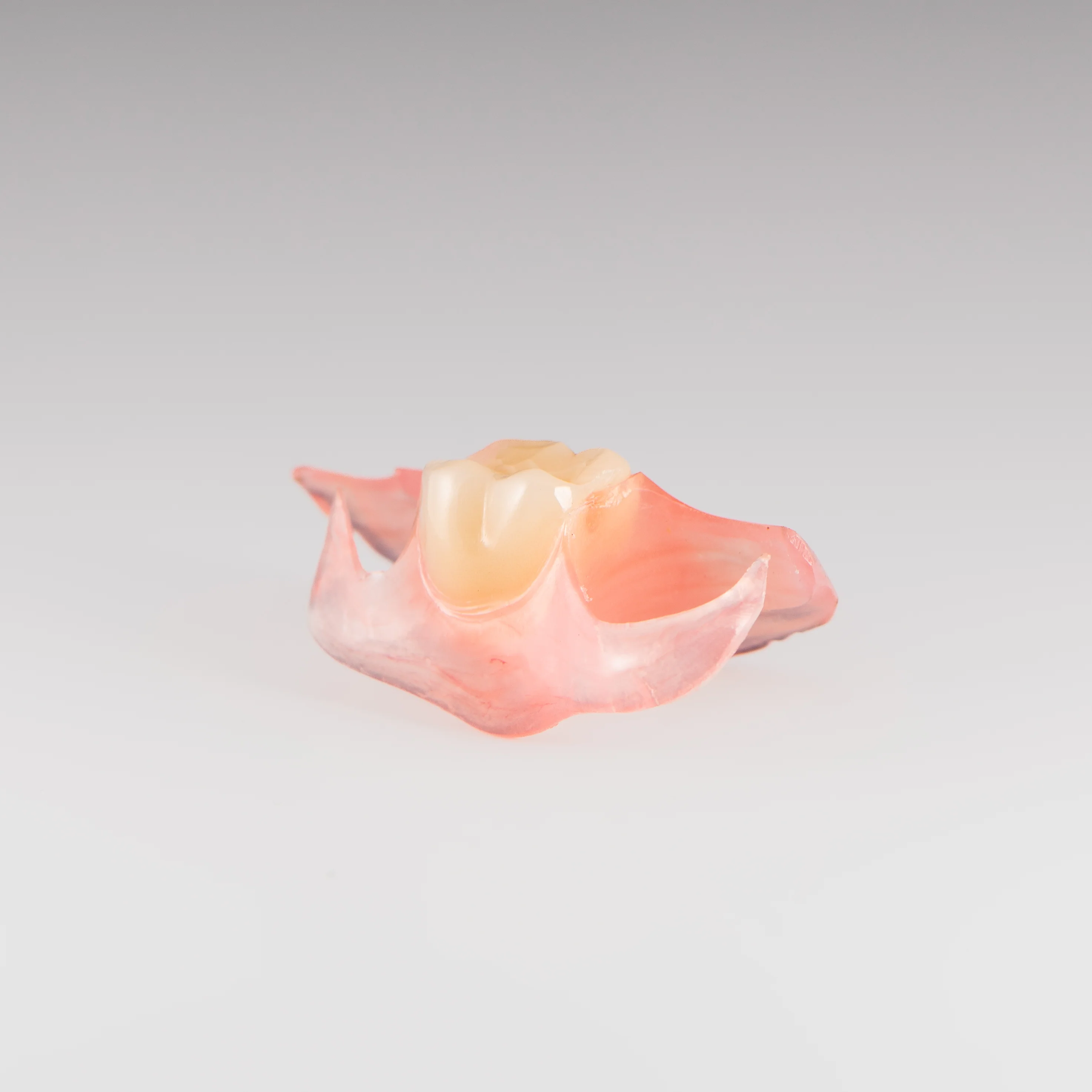 Unilateral Partial Denture - Image 9